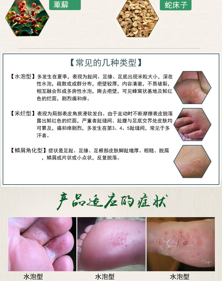 旗舰店花安乐喷剂去止痒灰指甲佳和足舒美4盒装