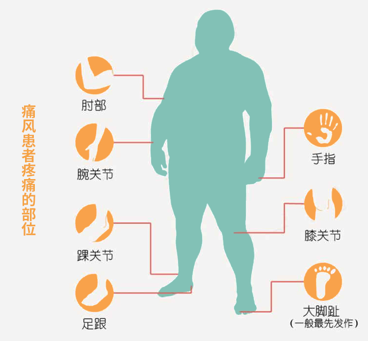 尿酸檢測儀家用血糖血脂總膽固醇三高測試儀高精準的儀器試紙尿酸試紙