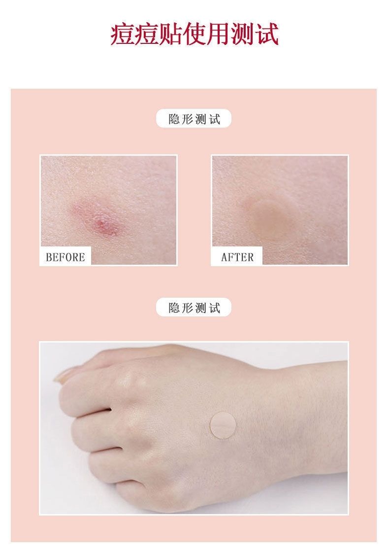 痘痘贴隐形净痘贴卡通淡化痘印青春痘针2盒痘痘贴星星款