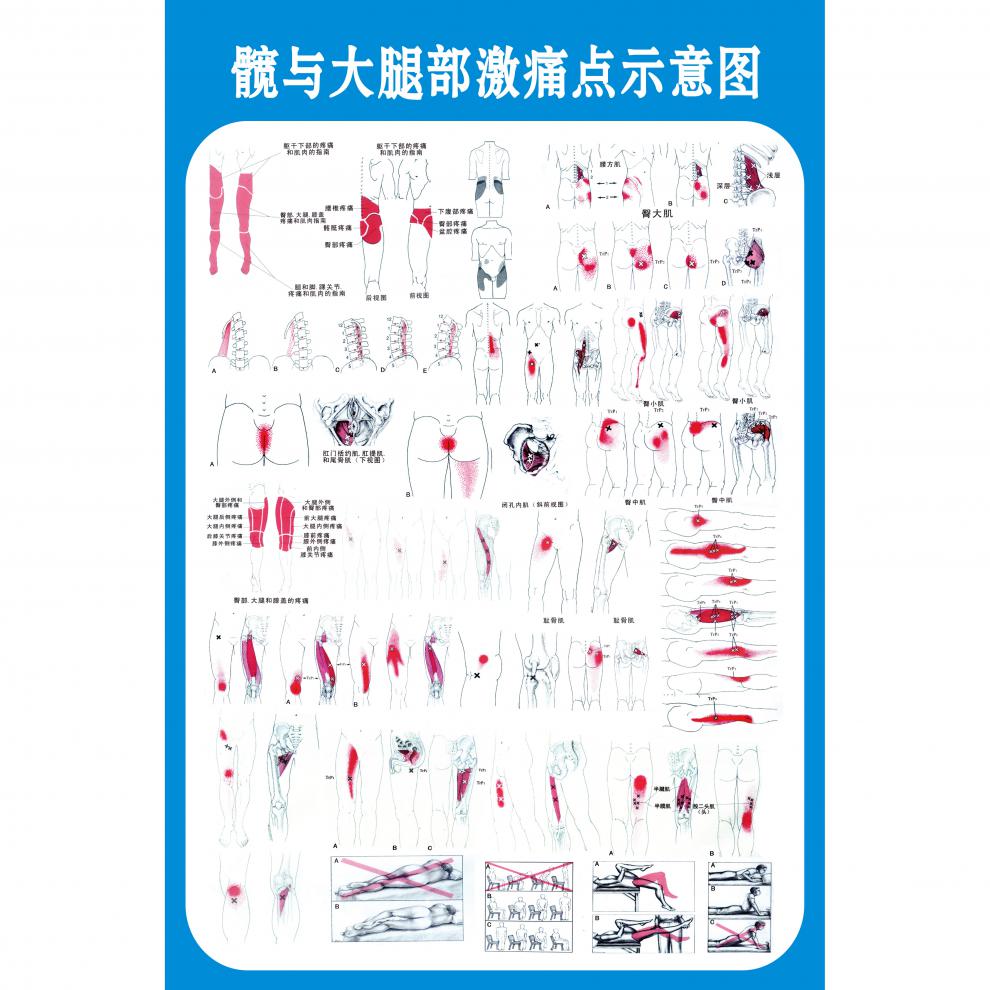 筋膜疼痛触发点示意图解人体肌肉解剖图解墙贴 肌筋膜疼痛触发点挂图
