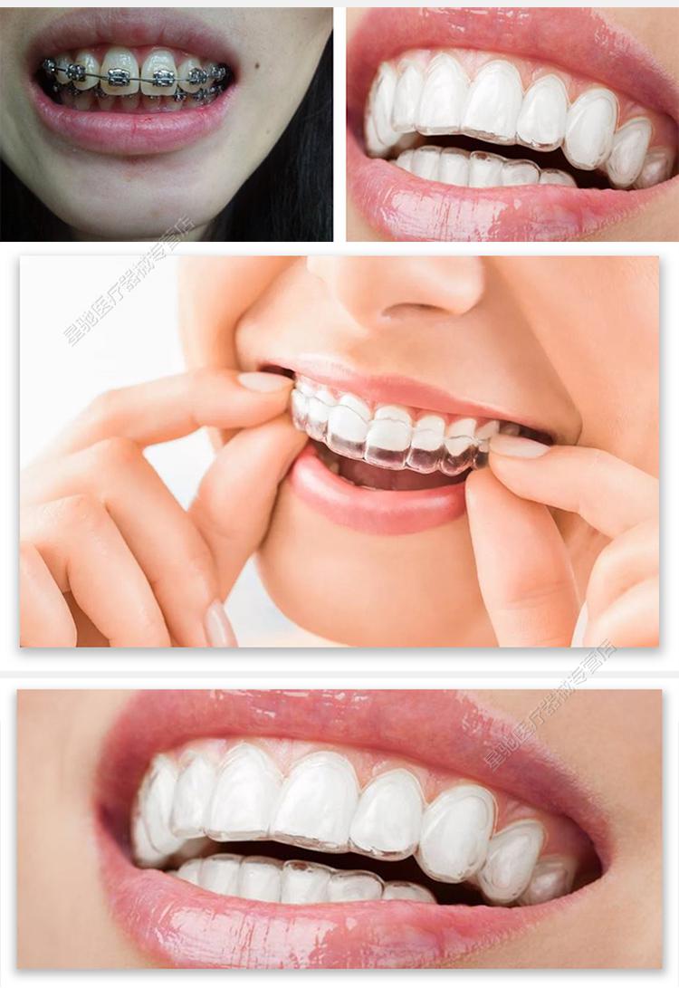 品牌优选牙齿器隐形牙套钢丝成人地包天龅牙透明牙齿定制保持器娇之乐