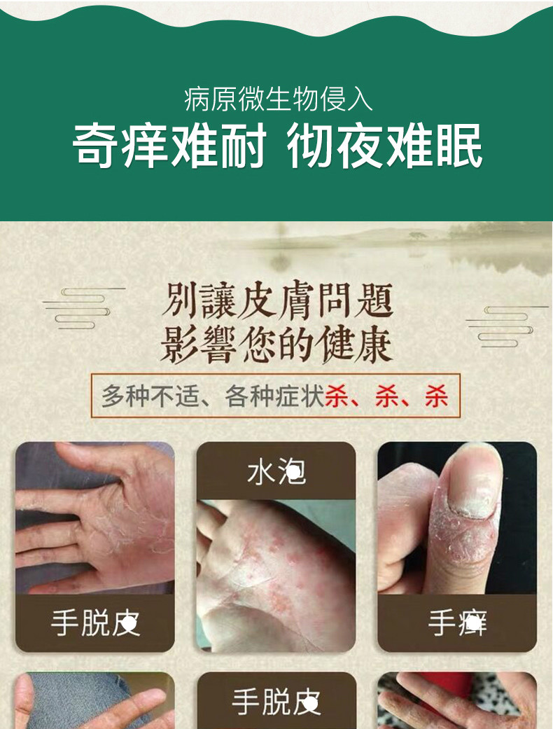 芙之馆云南神龙百草膏30g荨麻芷痒风团划痕急慢性过慜膏成人外用皮肤