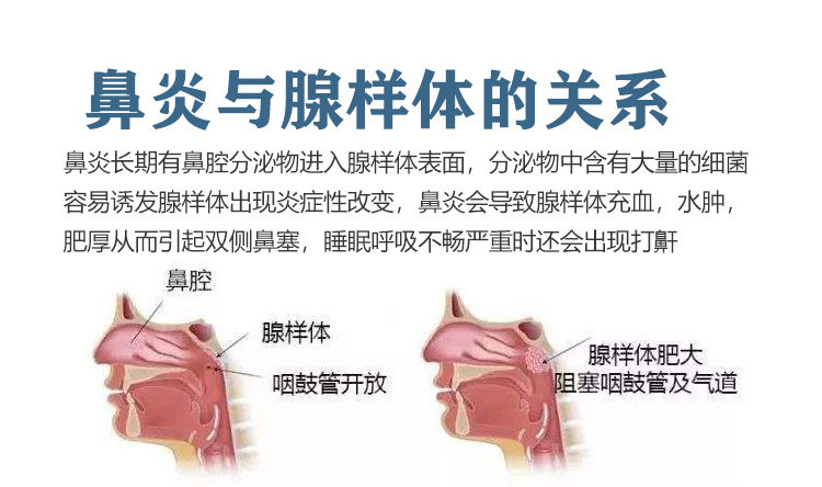 过敏性鼻炎照片 鼻腔图片