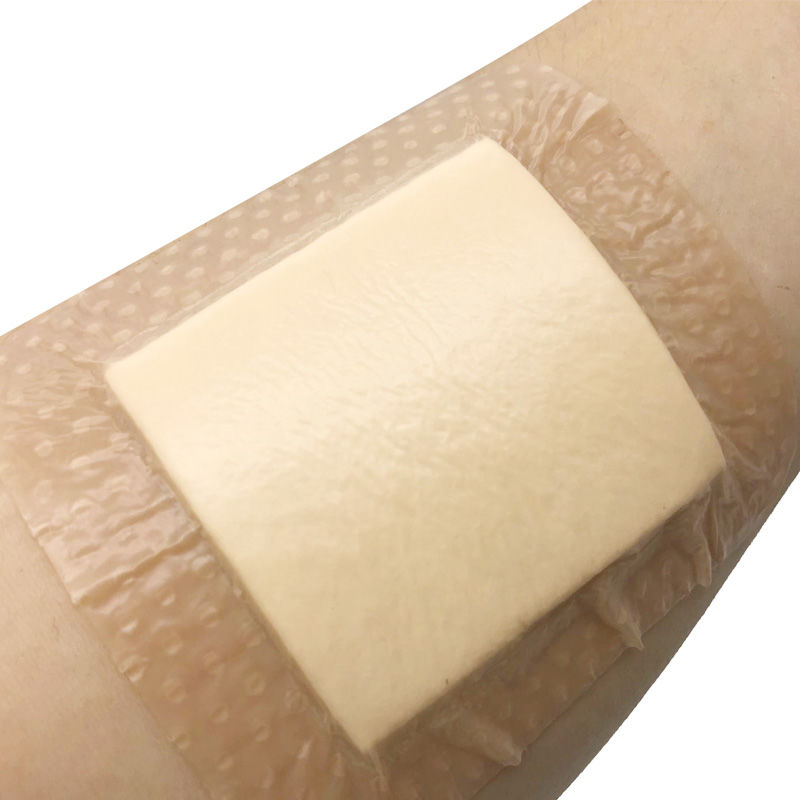 3420拜尔坦自粘泡沫敷料施莱康硅凝胶泡沫敷料褥疮贴施莱康1010cm1片