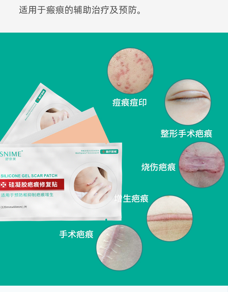 舒奈美医用疤痕贴医用硅凝胶疤痕贴克除淡化疤痕膏 1盒(3贴装)【图片