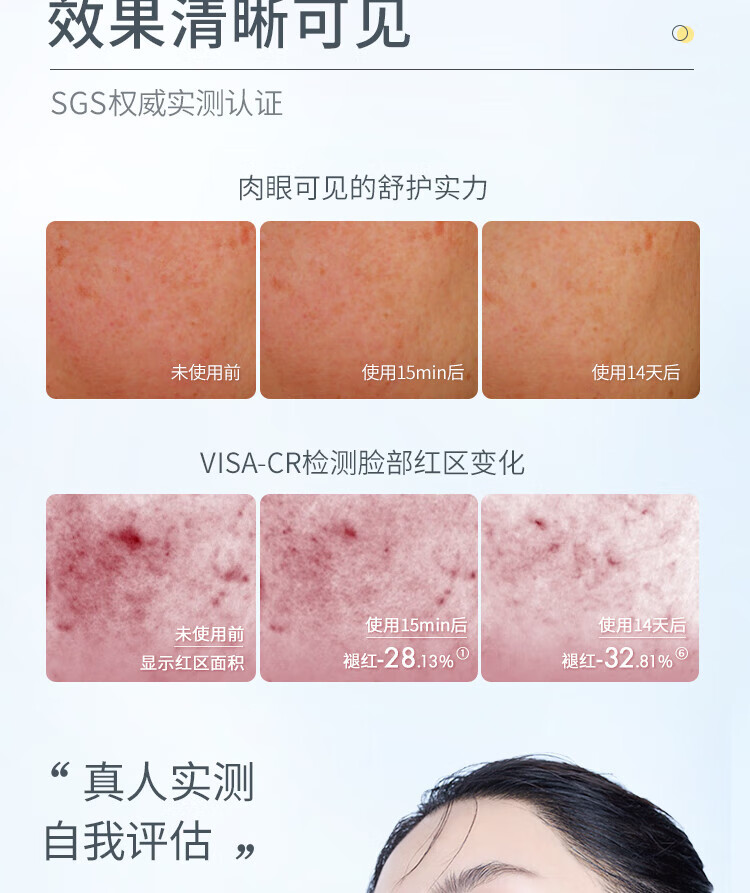 悦芙媞油橄榄面膜保湿舒缓修护屏障面膜熬夜女泛红退红维稳敏感肌学生 油橄榄面膜1盒