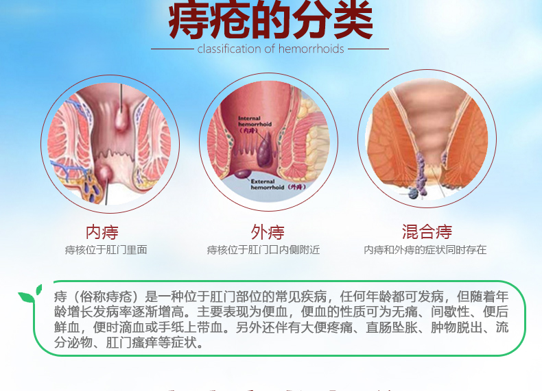 痔疮栓要塞多深图片