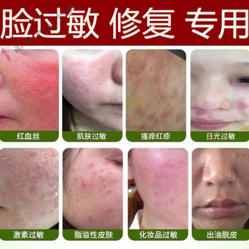 官方旗舰过敏修i复霜抗过敏脸部脸面部脸过敏膏止i痒红痒舒敏膏舒敏膏