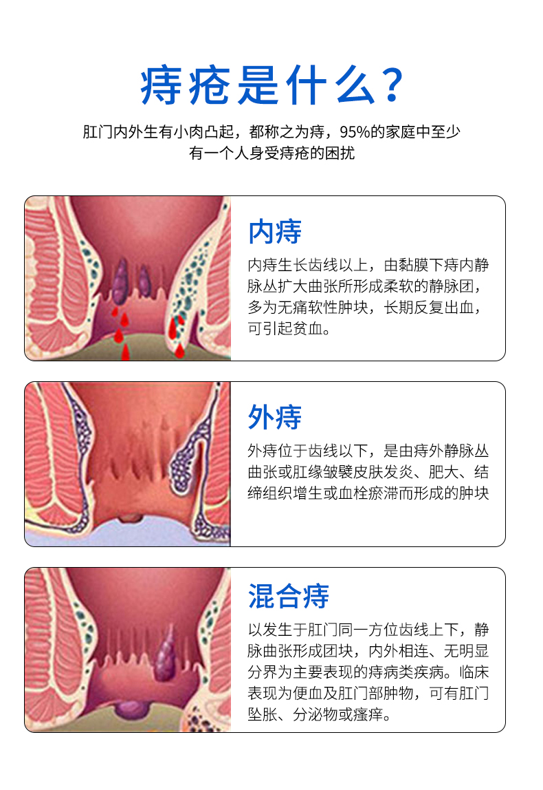 修康志清舒 鹤古安志清舒内外混合z痔c疮 两盒缓解装 套装