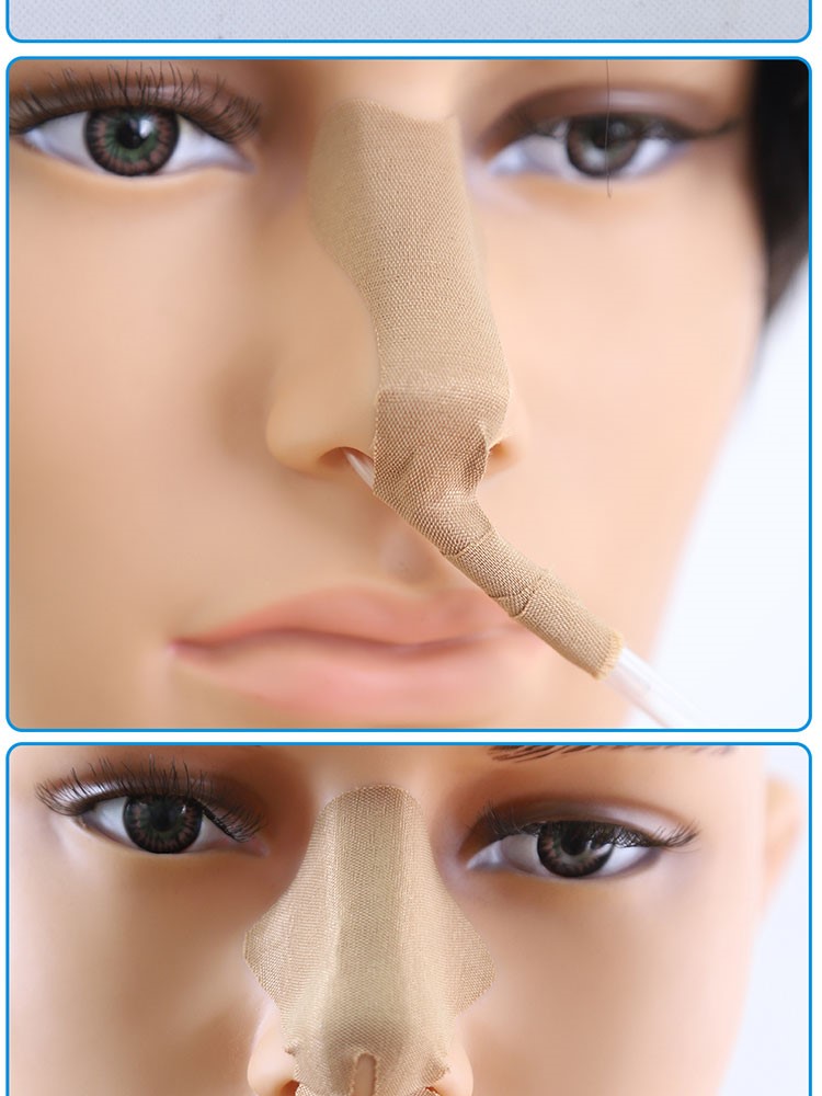 鼻梁贴导管固定装置贴胃管鼻饲管鼻贴鼻饲胶布贴护理卧床l型单管5片装