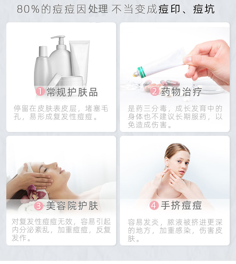 艾芭薇初中生青少年控油祛痘护肤品青春期男女补水保湿淡印闭口粉刺黑头 祛痘洗面奶+水+乳+祛痘凝露4件套