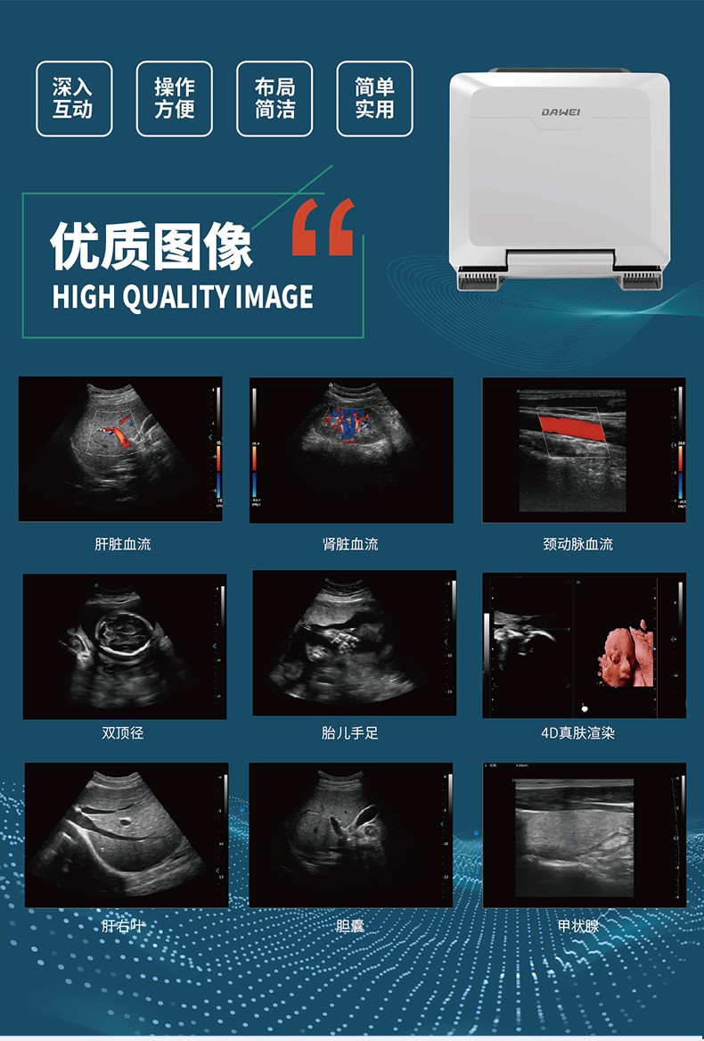 彩色多普勒超声诊断仪dw-pf580 dw-pf580浅表5000/支,阴超5000/支