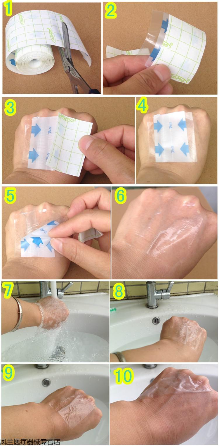 剖腹产手术后洗澡伤口防水贴透明薄膜可裁剪自粘胶布15cm5m
