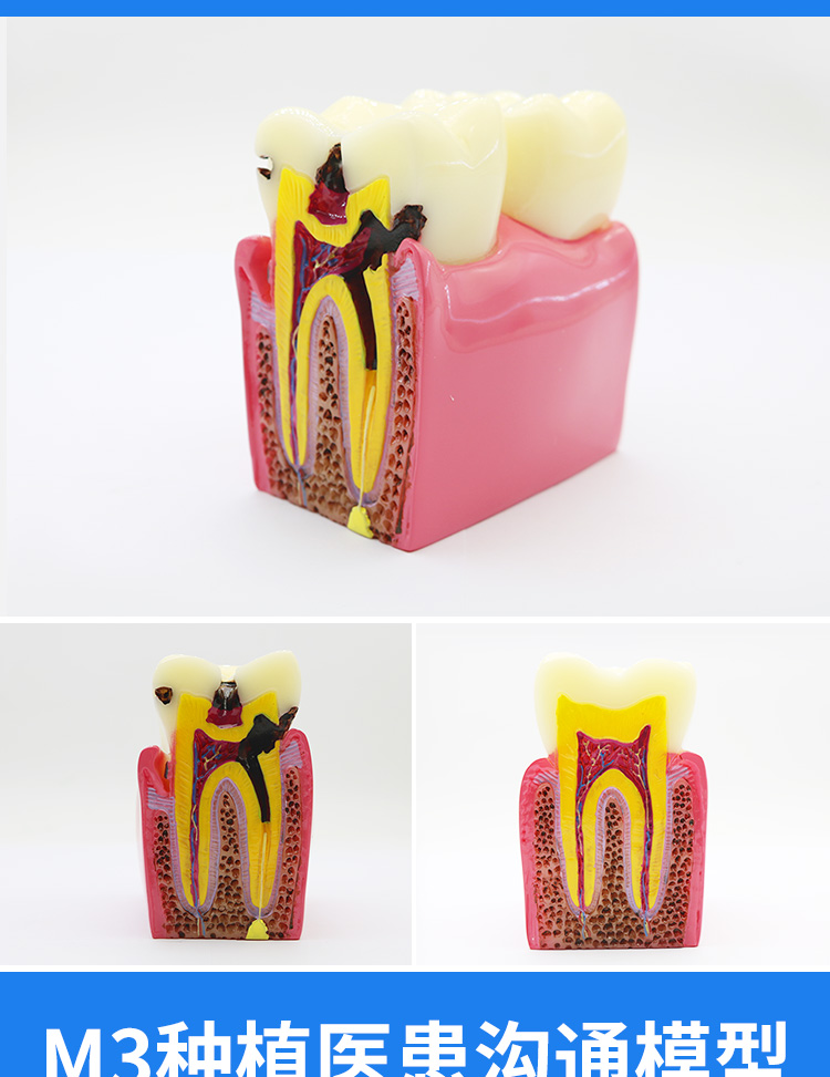 牙齿口腔模型牙科牙模型模具牙齿模型牙科教学模型可拆卸口腔假牙刷牙