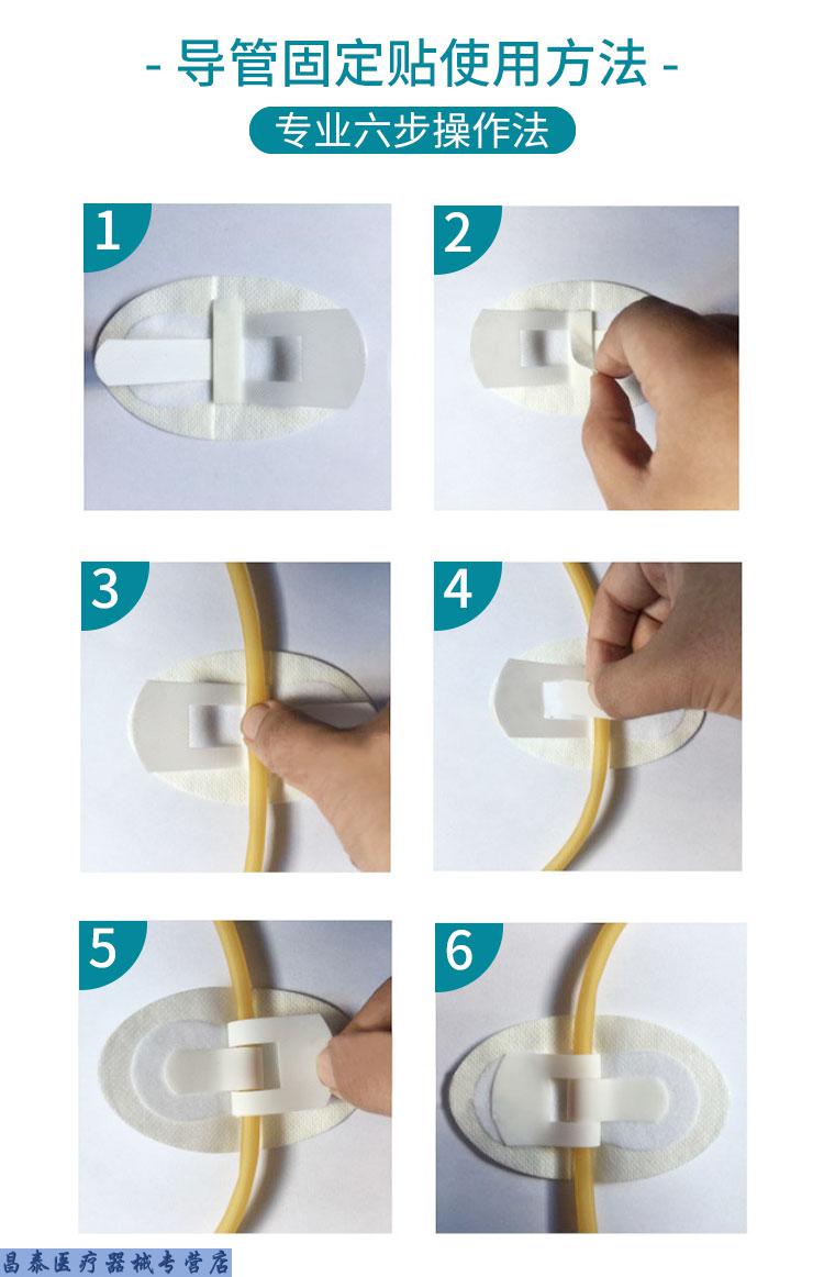 中拓体表导管固定贴鼻梁贴导管胃管胶带固定胃管鼻饲管鼻贴鼻饲胶布贴