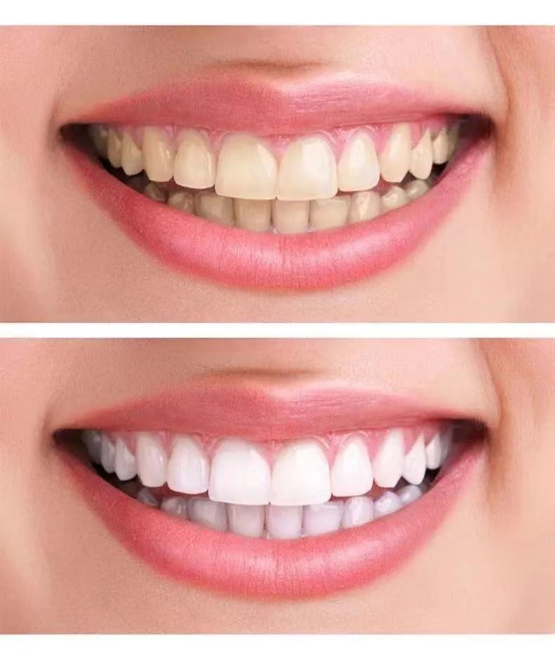 云南本草洗牙粉洗白牙齿牙垢牙结石快速亮白牙去黄牙烟渍茶渍 云南