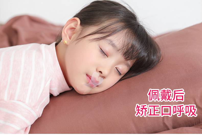闭嘴口呼吸器闭合封唇胶带睡觉防张嘴神器儿童小孩嘴巴封口贴 x型透气