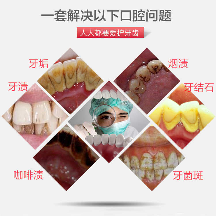 工具牙石去除器抠牙石刮牙垢清理牙齿洗牙神器单支加厚刮舌器指甲剪