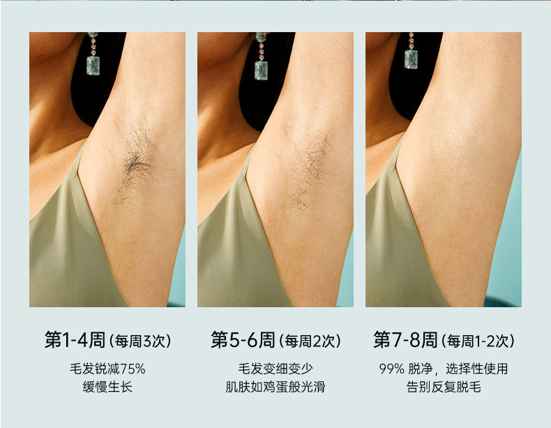 侨源 冰点激光脱毛仪器家用神器腋下私处脱毛机女全身无痛脱毛器 冰晶