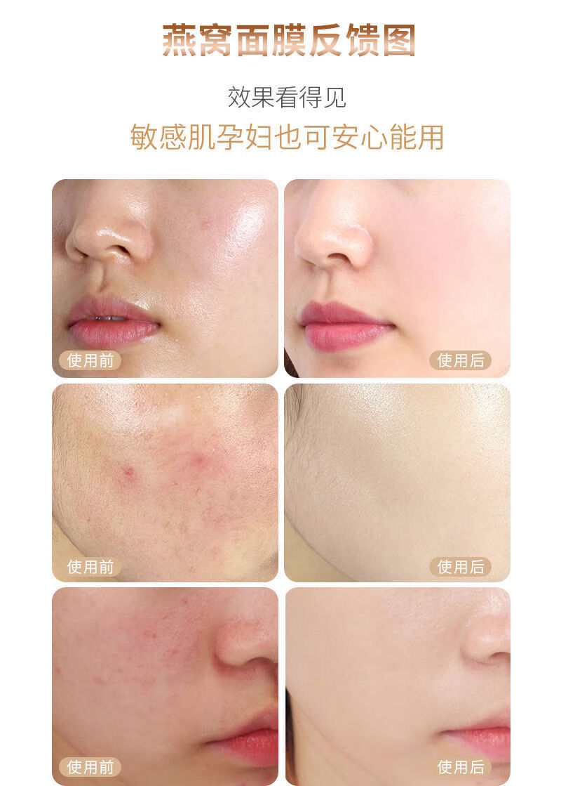 方旗舰兰菲丝面膜lafansee兰菲丝燕窝面膜补水保湿美i白去i黄收缩男女