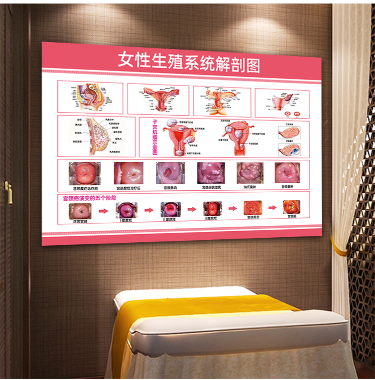 医院诊所海报挂图人体器官贴纸女性生殖器结构图解妇科器官解剖画 09