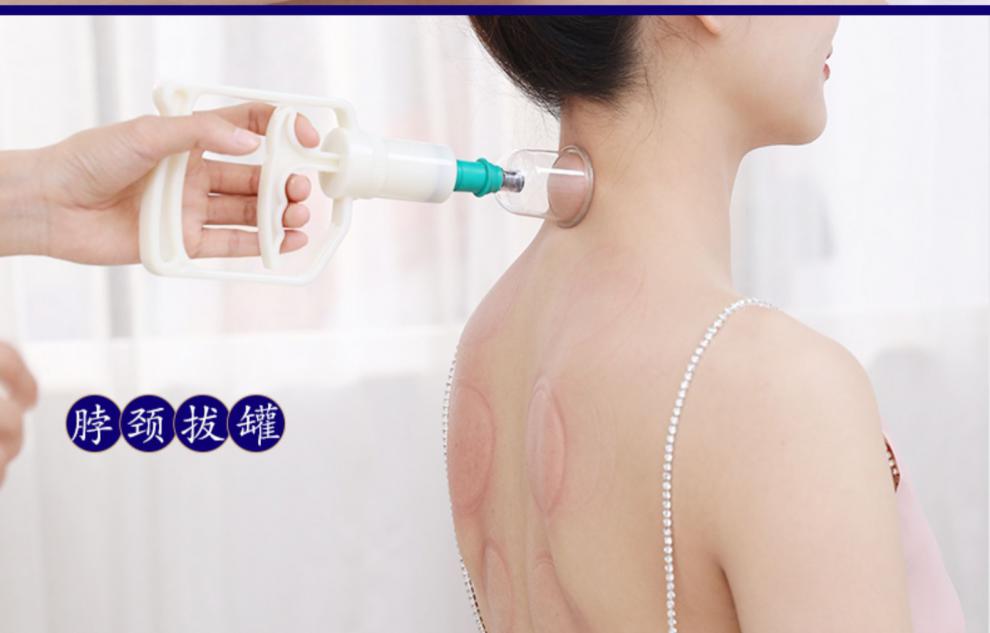 康祝 拔罐器理疗拔罐家用抽气式真空气罐火罐工具中医专用全套套装