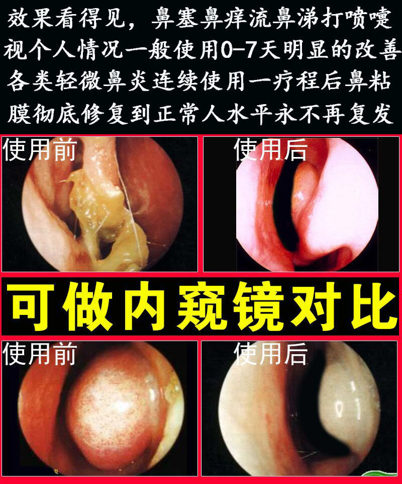 鼻炎膏鼻窦炎过敏性鼻炎鼻塞鼻痒鼻甲肥大云南滇草 发5瓶【图片 价格