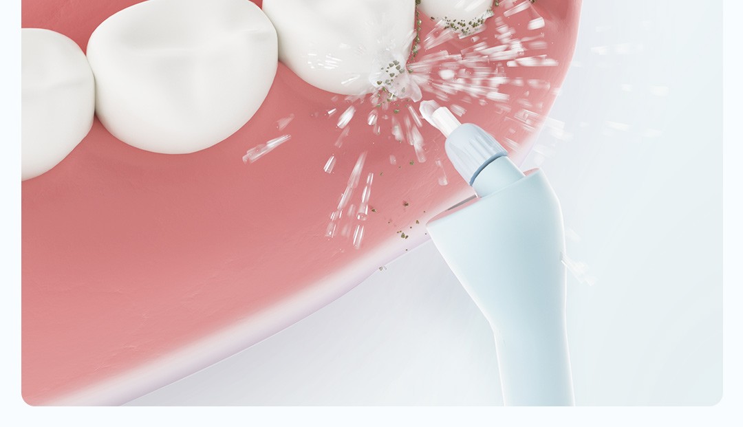 小米有品素诺智能可视冲牙器冲牙器高频脉冲水喷水牙齿冲洗机清洁器