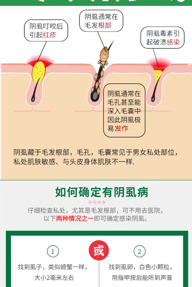 阴虱成人私处灭阴虱冶好阴虱一扫光百部酊虱立清虱无踪3盒装