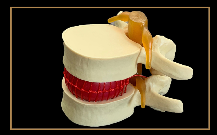 人体腰椎间盘演示模型腰椎模型脊柱模型脊椎模型关节模型娇之乐姜黄色