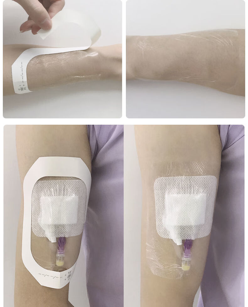 导管固定贴picc医用透明敷料贴化疗洗澡防水贴中心静脉留置针贴片67cm