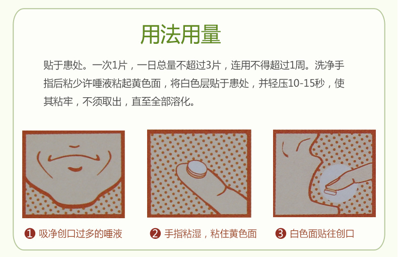 意可贴 醋酸地塞米松口腔贴片0.