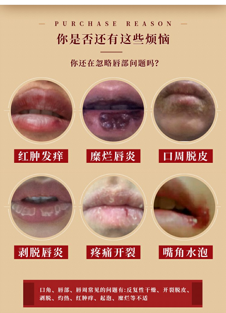 免费试用 联格源禾轩 唇愈膏嘴唇干裂脱皮去泡修护 官方 佳品堂唇御医