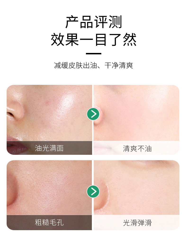 倾龄【官方直售】微酸积雪草小气泡面膜mdb自发泡收缩毛孔去清洁黑头 1瓶装【拍2瓶到手4瓶】