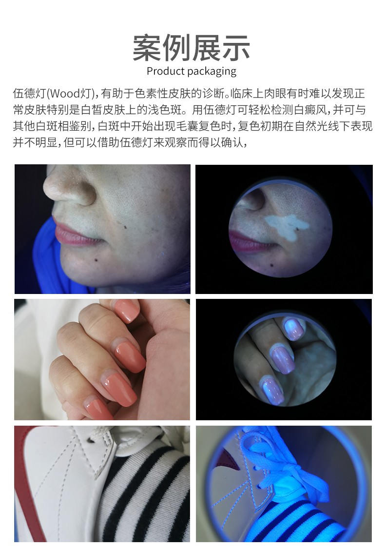 blueseitech伍德灯wood灯白癜风皮肤诊断器医用皮肤放大镜家用紫外线