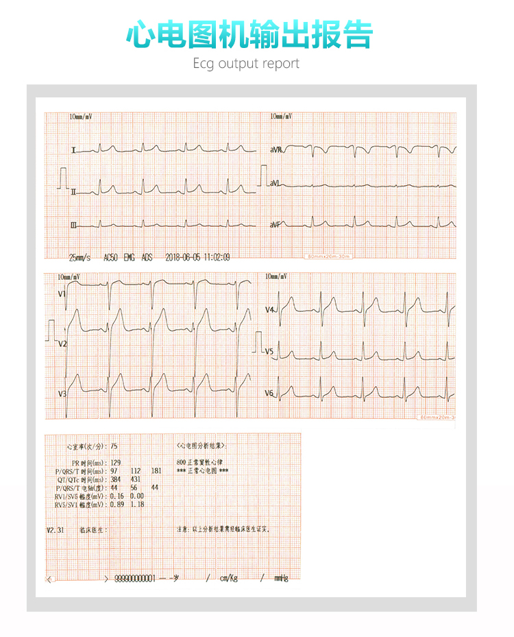 三锐心电图机的设置图片