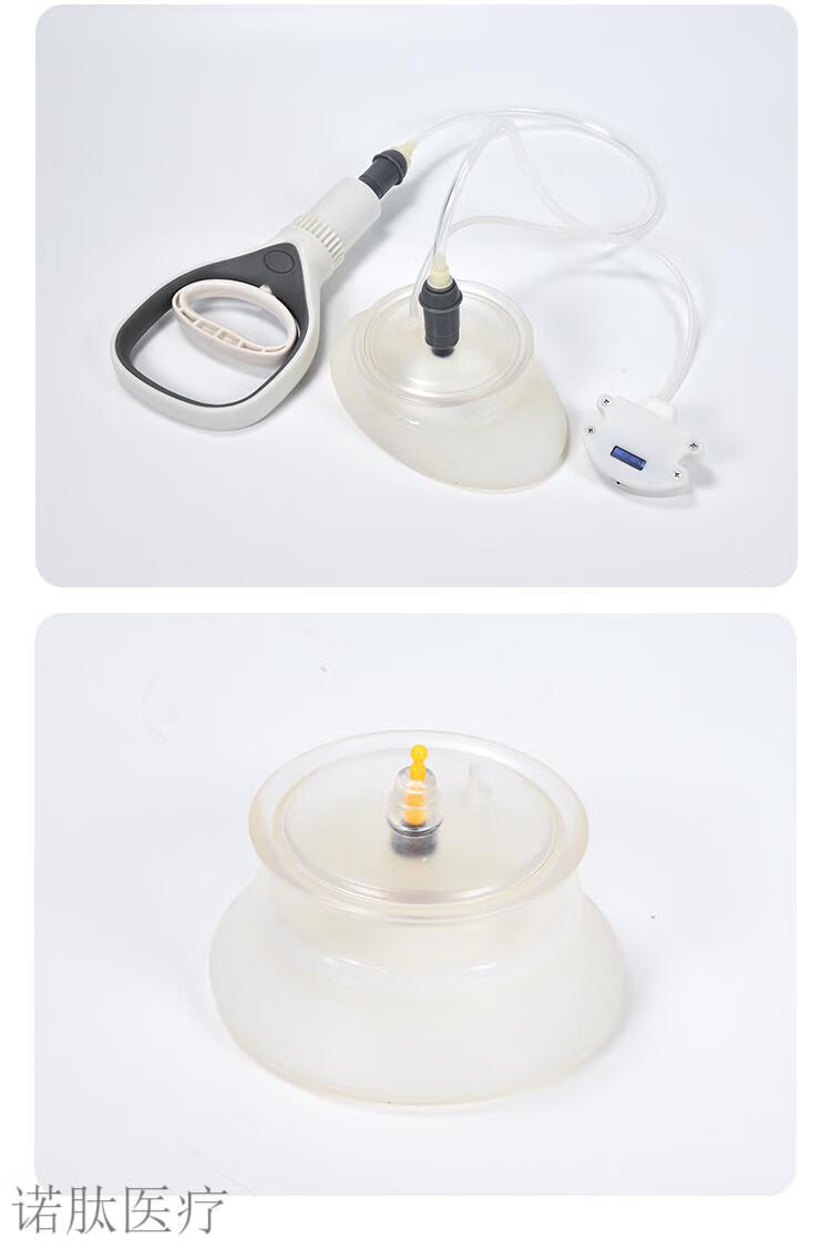 压力显示漏斗胸负压吸盘理疗器矫形器儿童专用 3d定制款漏斗胸吸盘