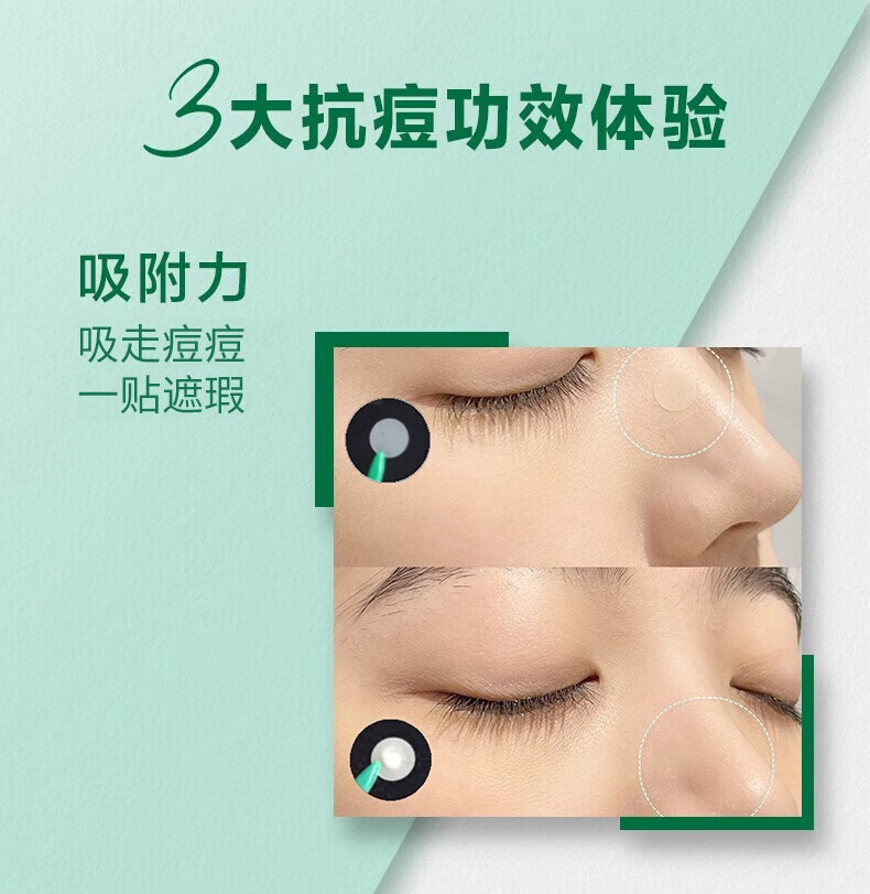 曼秀雷敦（Mentholatum）痘痘贴 乐肤洁隐形净痘贴抑制 痘痘修护 隐形净痘贴26片