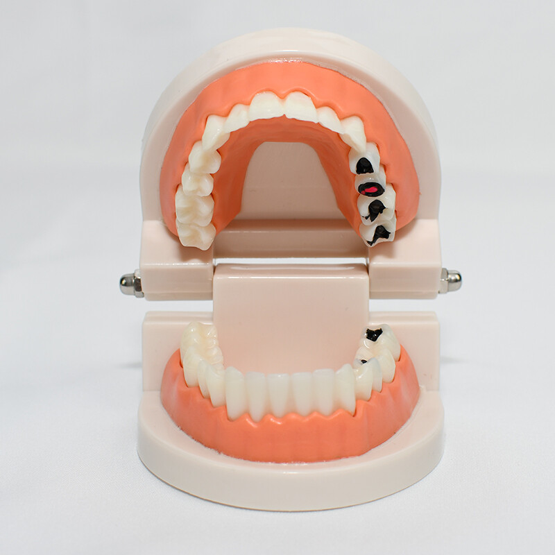牙齿模型 美牙练习工具材料牙齿美白练习树脂牙模假牙