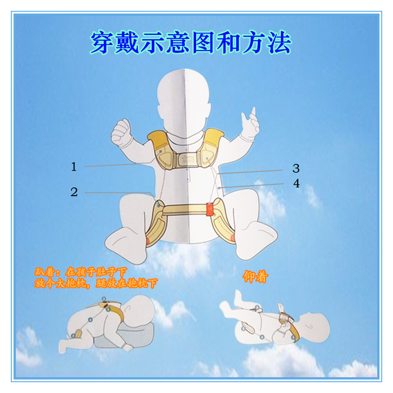 蛙式支架正确佩戴方式图片