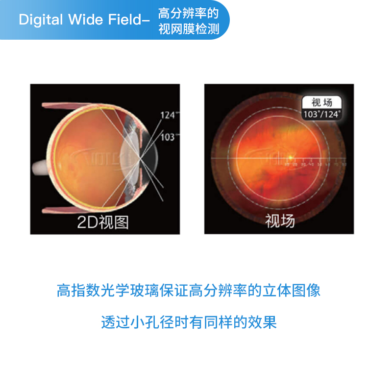 【药房直售】沃克volk 90d眼科裂隙灯前置镜digital wide field第三代
