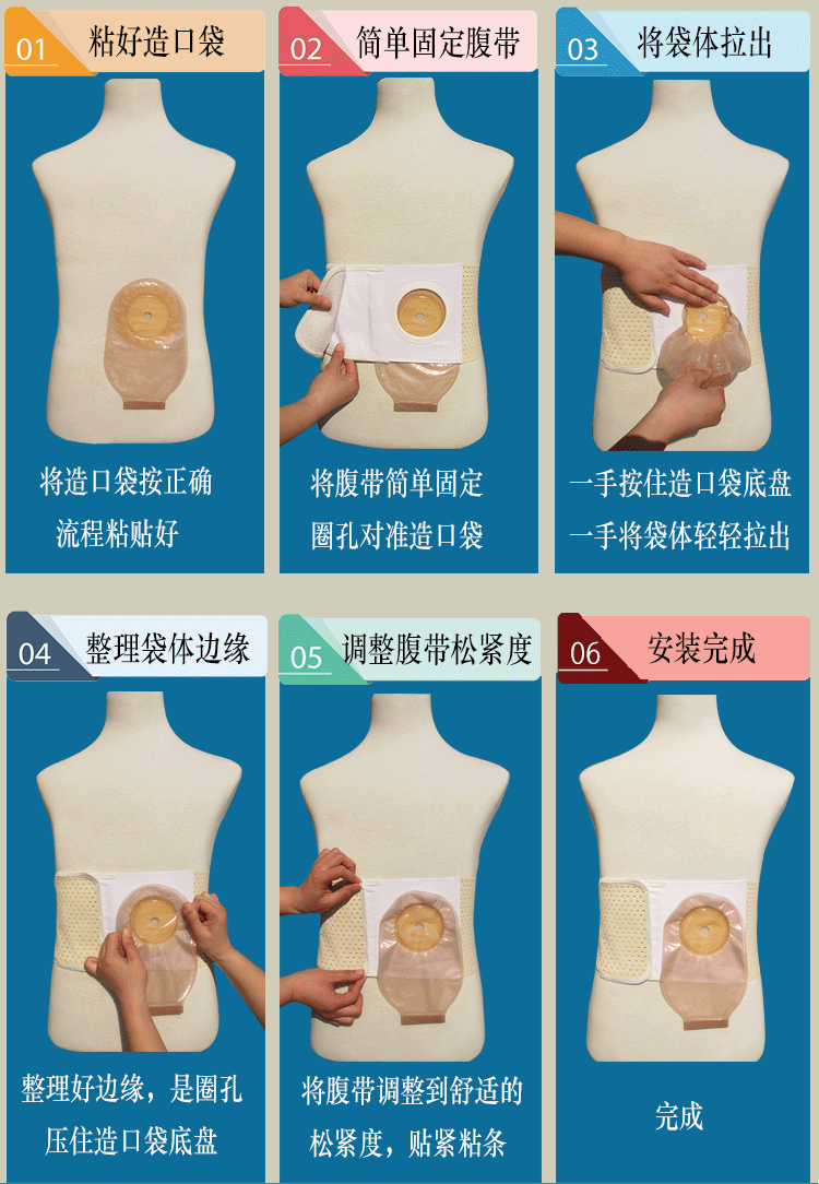 造口腹帶造口收腹帶專用固定腰帶式旁疝彈力護腰護理加寬透氣腰圍夏季