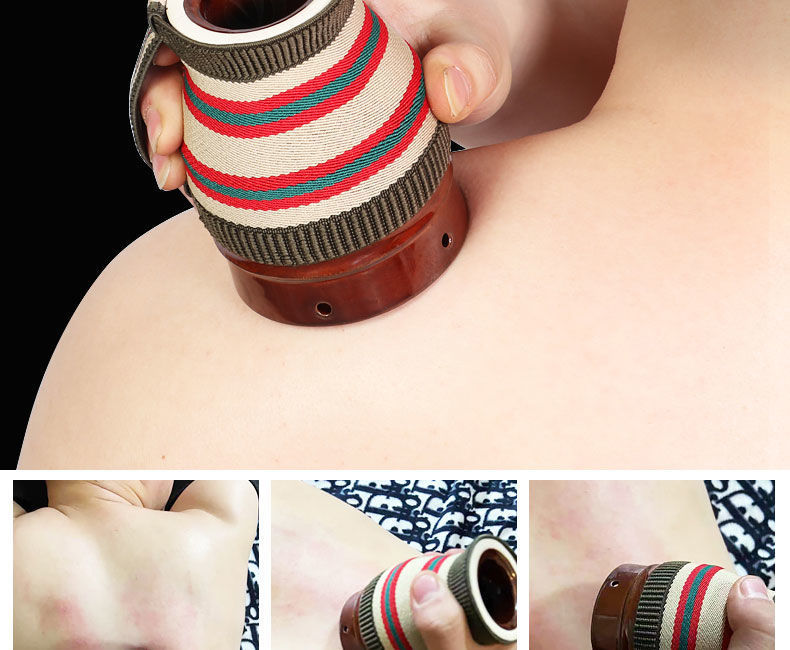 扶阳罐陶瓷养生器械双层陶瓷艾灸罐大罐艾灸刮痧杯仪器家用随身灸艾灸