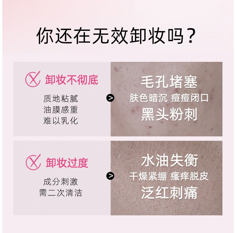 高丝（Kose） 日本原装 高丝 泡沫卸妆洗颜料卸妆温和清爽易冲洗高保湿水润不紧绷洁面乳洗面奶 卸妆油 230ml