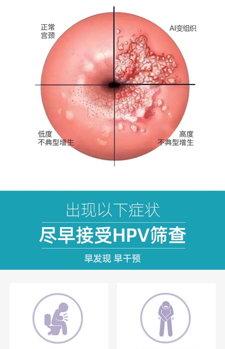 抗hpv病毒凝胶 阻断高危型hpv感染预防宫颈病变高危转阴抗干扰素凝胶