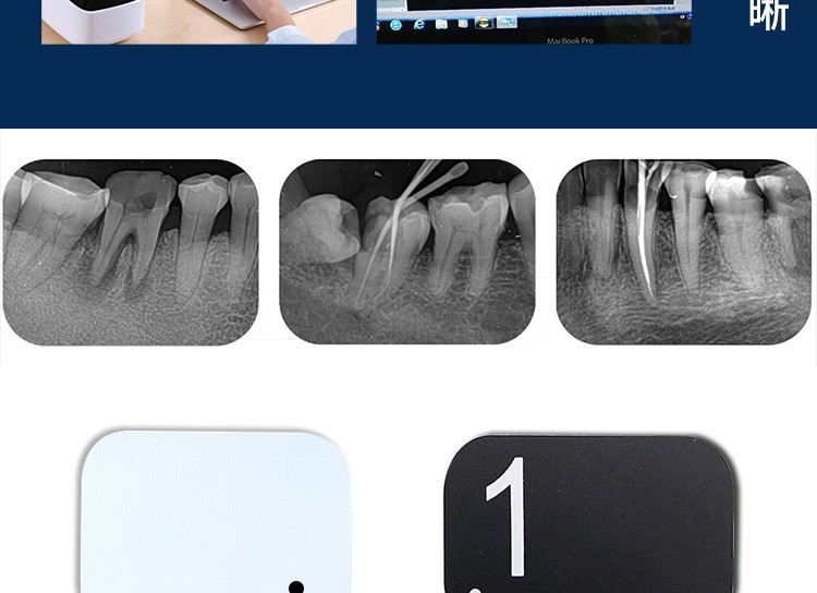 牙科牙片宝ip板卡瓦菲森牙智宝牙片口腔磷光片2#成像扫描板感光板