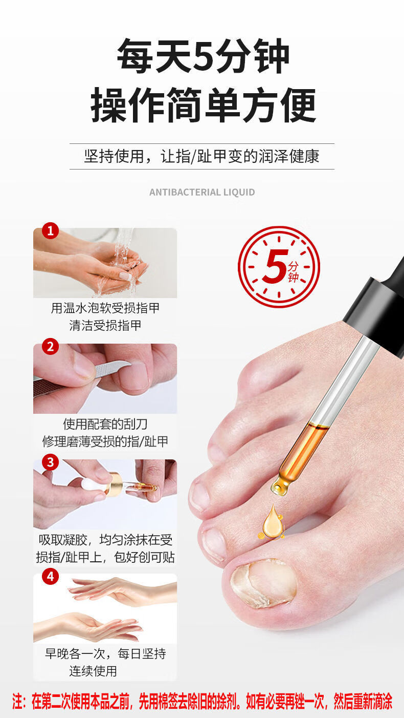 镇平浅i米草15号灰指去除坏软脱修复液增厚灰指甲液30ml2瓶装