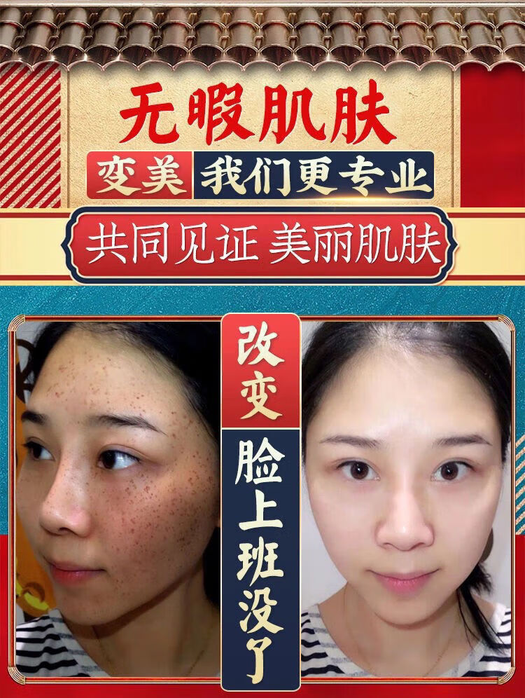 【官方旗舰】大长今美白 红颜秀大长今雪肌亮肤五合一美白霜套装盒