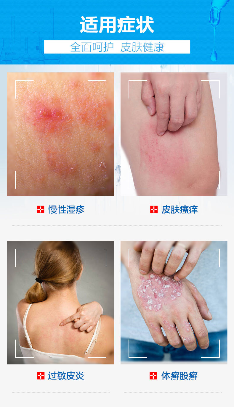 迪肤康迪凡贝臣山茶精华乳膏皮肤瘙痒外用湿l桢疹大腿内侧癣抑l菌止l