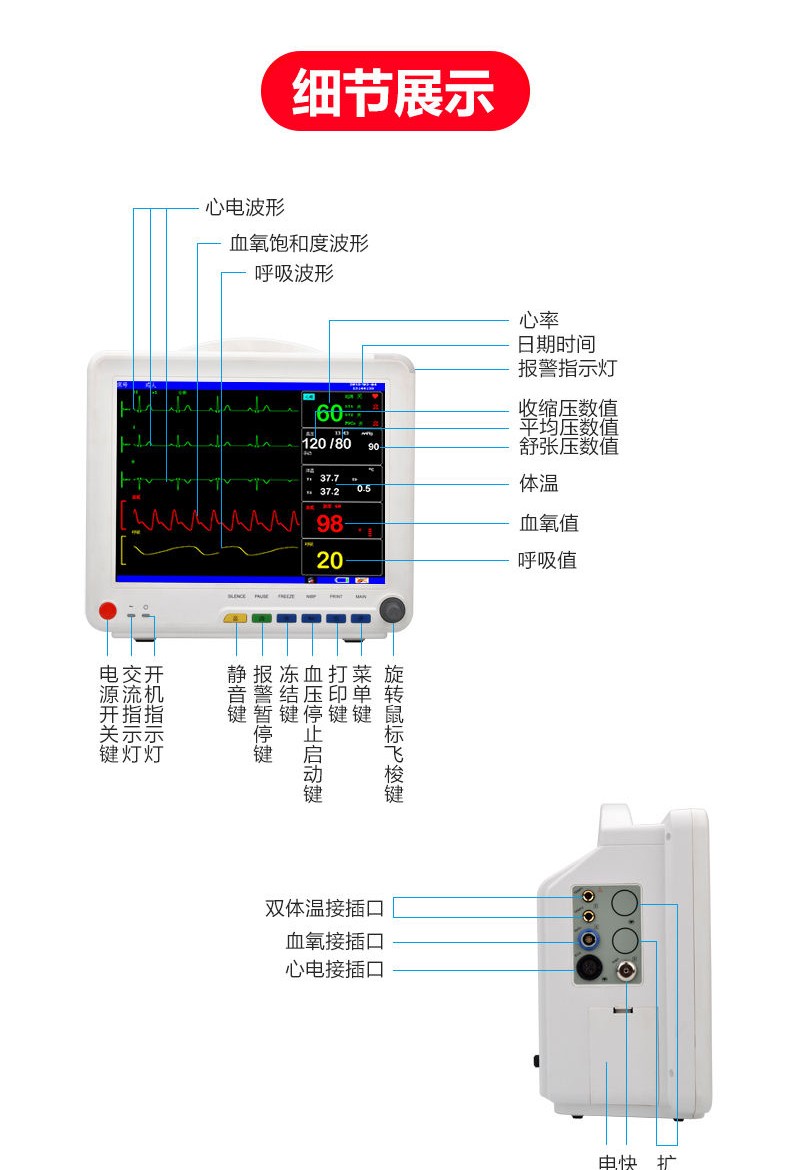 心电监护仪怎么看波形图片